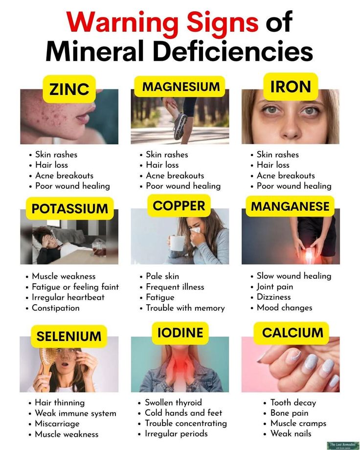 Mineral deficiencies